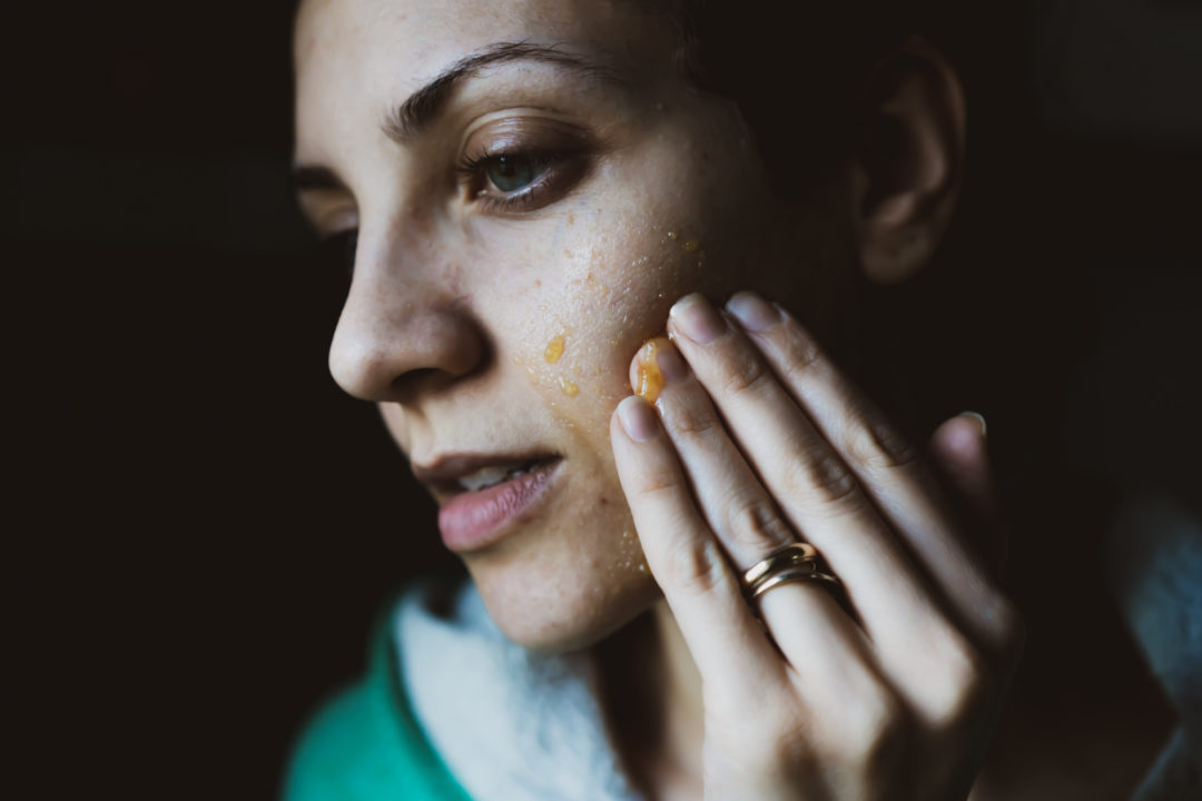 Applicazione maschera di olio e limone, viso donna